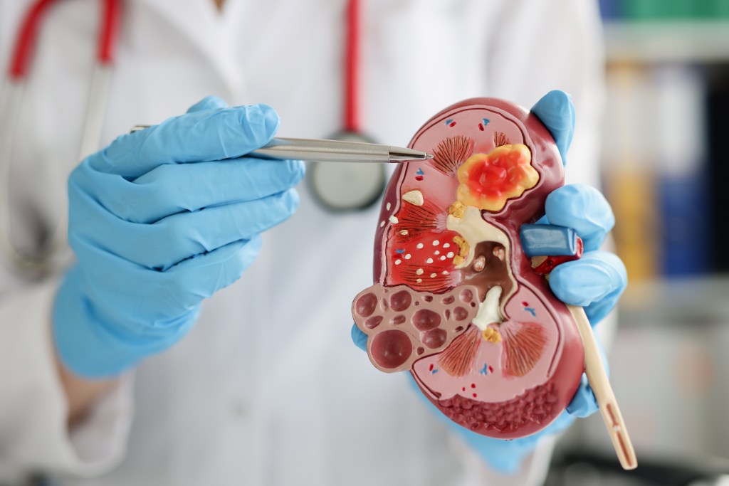 Close a doctor showing a kidney diagram. 